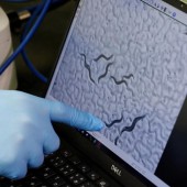 Công nghệ sàng lọc ung thư tuyến tụy nhờ giun